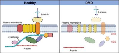 Satellite cell contribution to disease pathology in Duchenne muscular dystrophy
